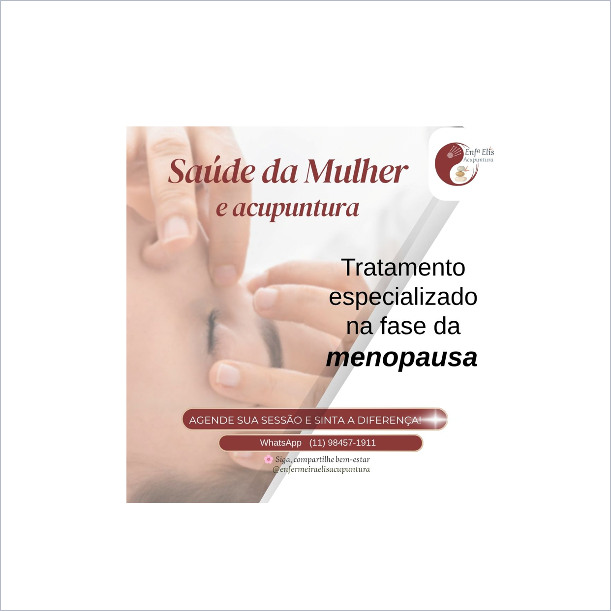 Acupuntura Integrativa, por Enfermeira Elis